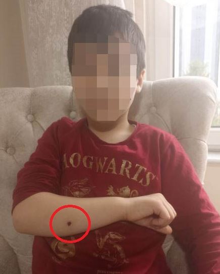 Samed Aydın SUN/KAYSERİ, – KAYSERİ’de, husumetli iki esnafın silahlı kavgasında,