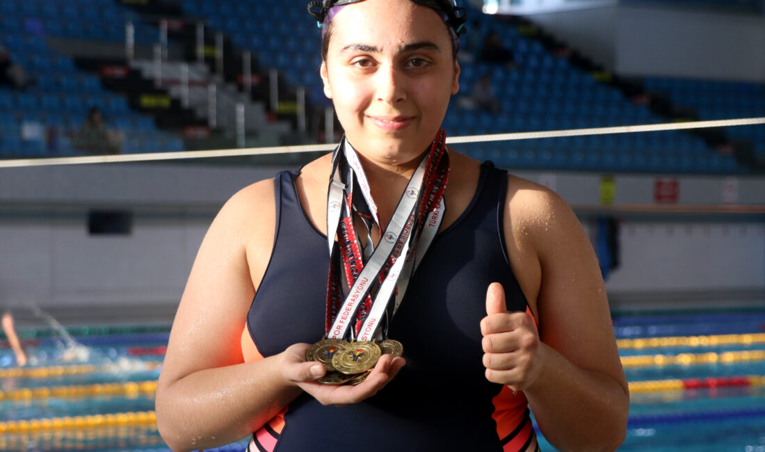 Furkan KAVUKLU / KAYSERİ, – KAYSERİ’de otizmli Elçin Erol (20),