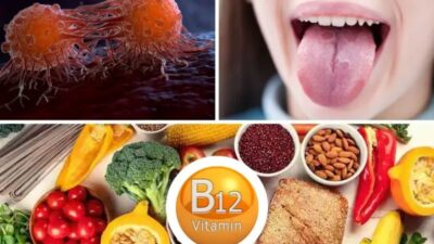 B12 eksikliği vücudu kanserle doldurur, bu 5 belirti ortaya çıkarsa