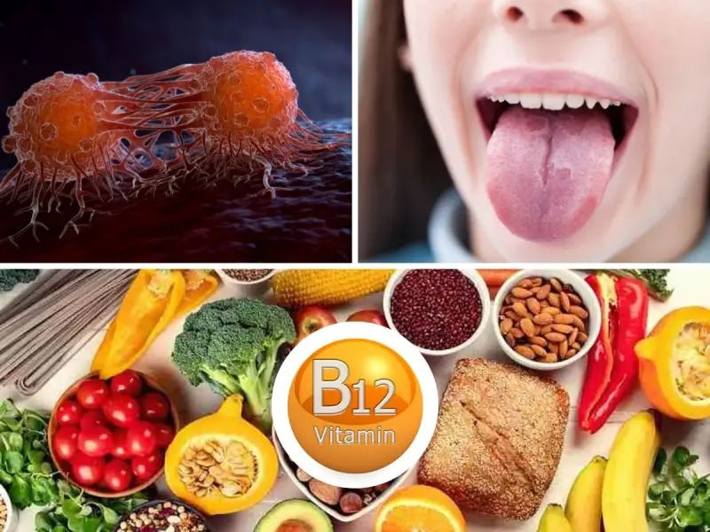 B12 eksikliği vücudu kanserle doldurur, bu 5 belirti ortaya çıkarsa
